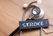 Cegah Stroke dengan 4 Pilar Utama dari Ahli Saraf dan Jantung Stroke dari kesehatan jantung